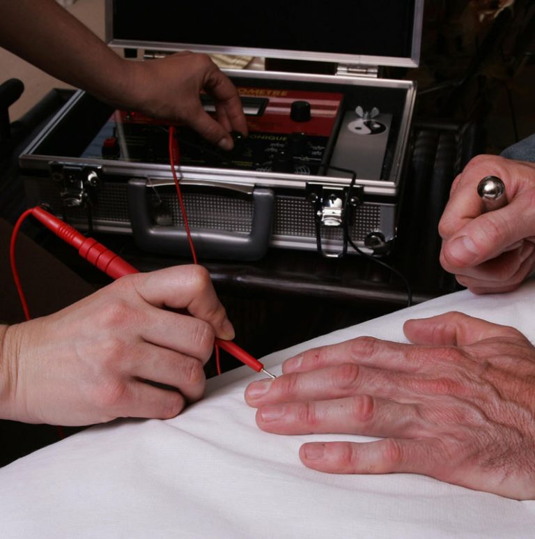 Commander un kit d'acupuncture, composition du kit et livraison